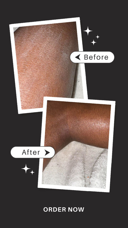 Shea Butter Body Balm